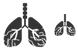 Lungs cancer