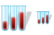 Blood test SH