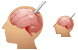 Brain probe