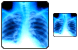 X-ray picture icons