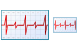 Cardiogram icons